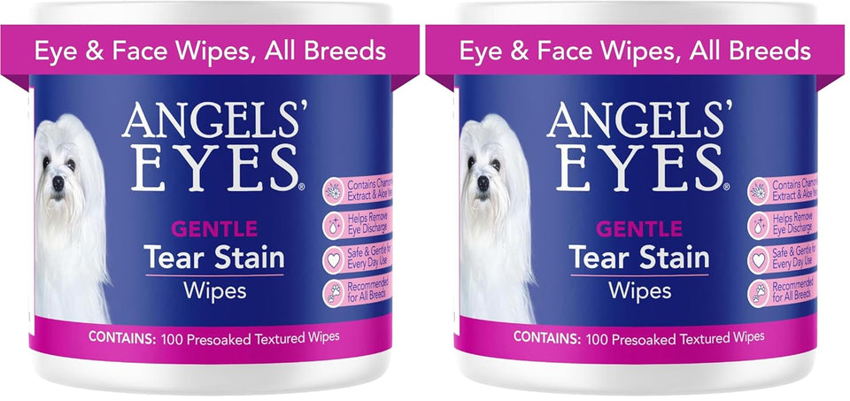 Angel's Eyes Gentle Tear Stain Wipes for Dogs and Cats, Presoaked, 100 Count, Textured